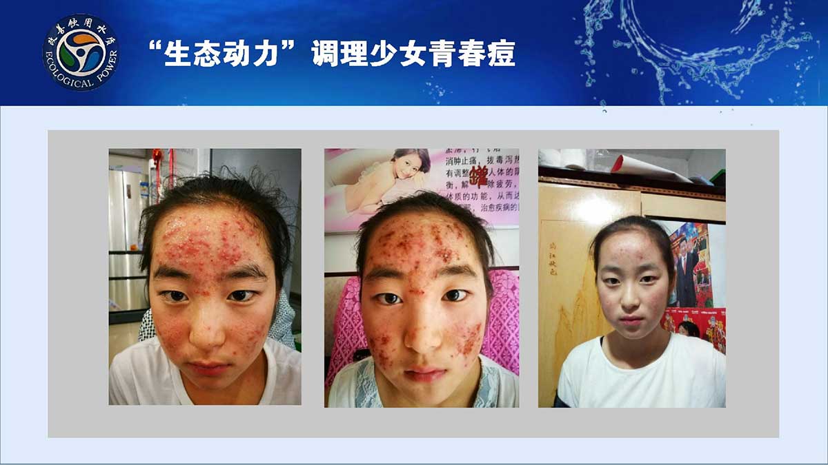 hth官方网页版成为维拉官方合作伙伴