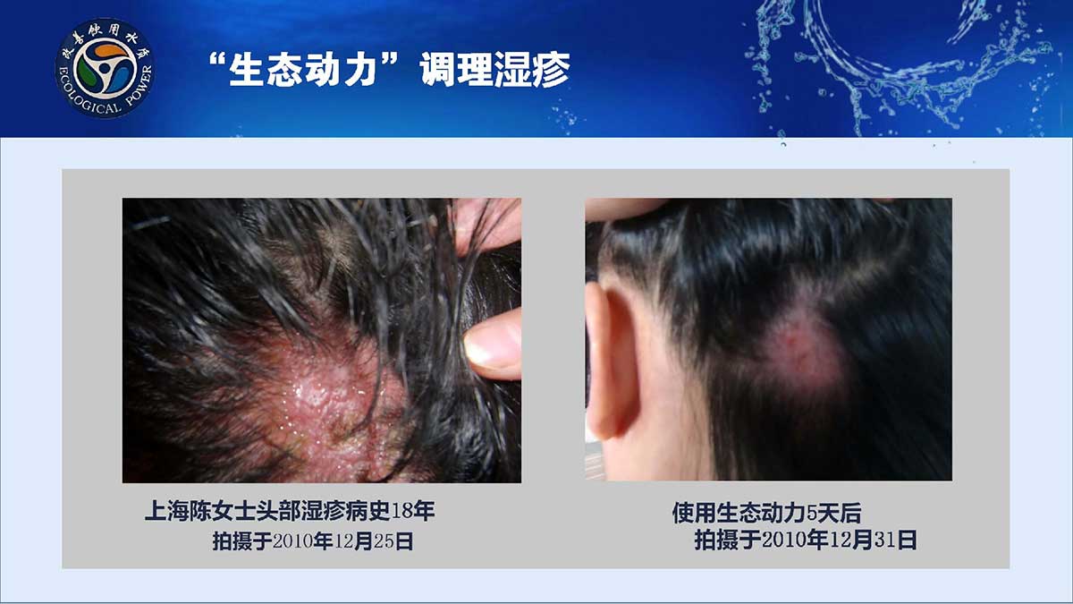hth官方网页版成为维拉官方合作伙伴